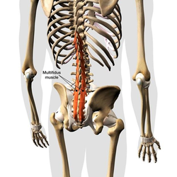 Multifidus Dysfunction: A Hidden Driver of Chronic Low Back Pain