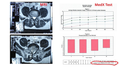 MRI vs. MedX: What is the Real Difference?