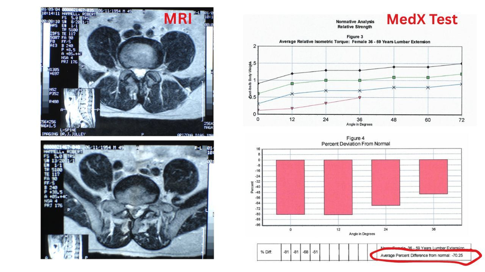 Split-screen graphic MRI vs MedX