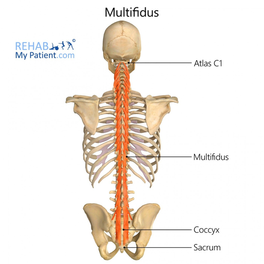 The Multifidus Muscles Role in Chronic Spinal Pain