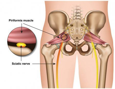 piriformis_muscle