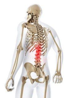 Resting for Back Pain